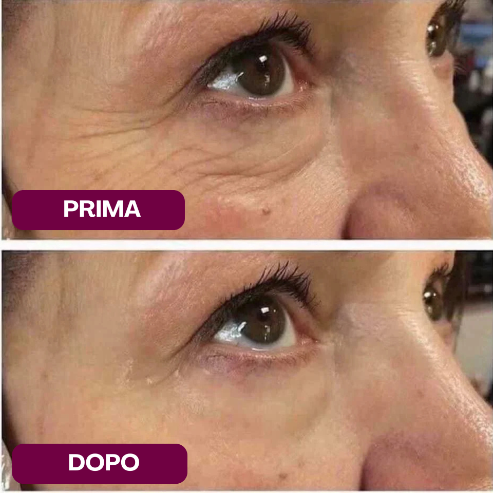 Primer Anti-Rughe Nimea™