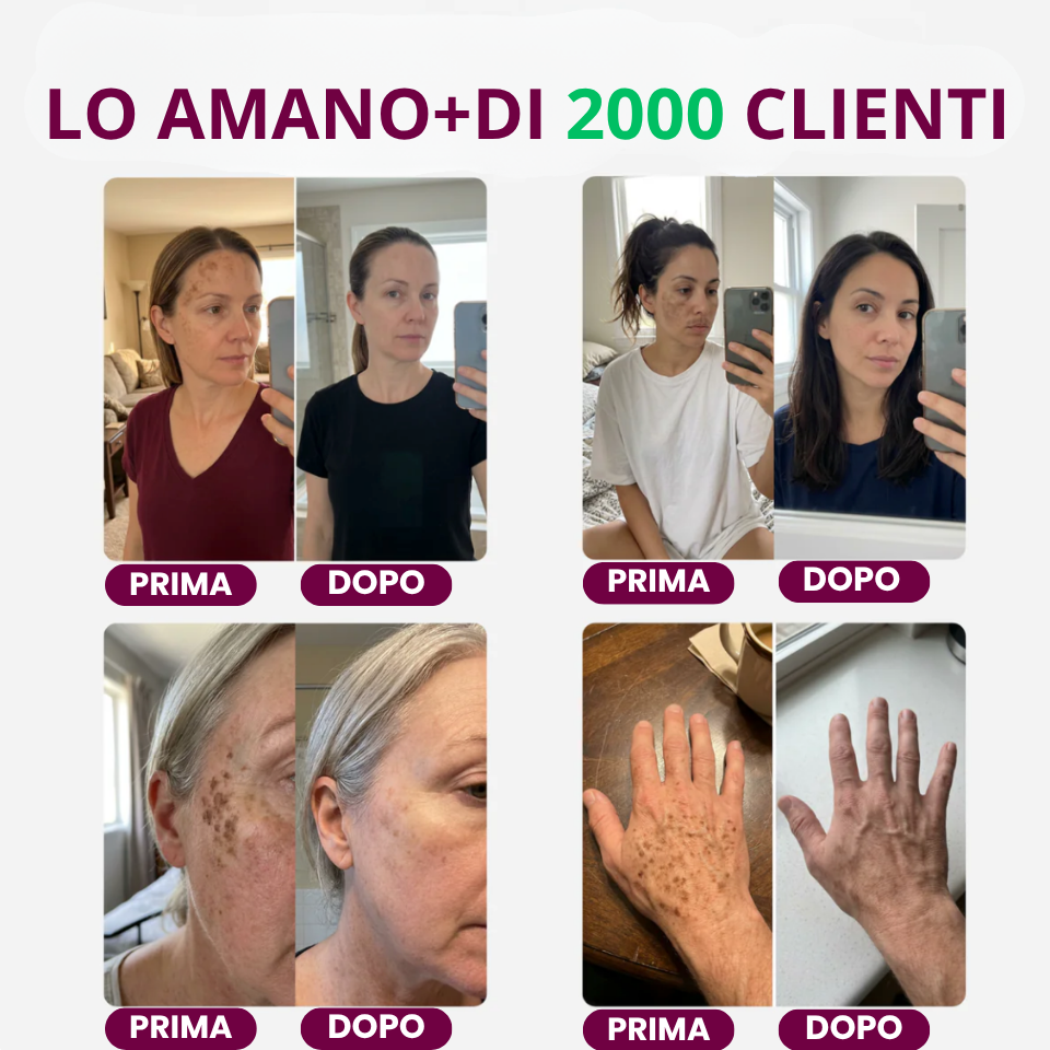 Nimea™- Crema addio macchie!
