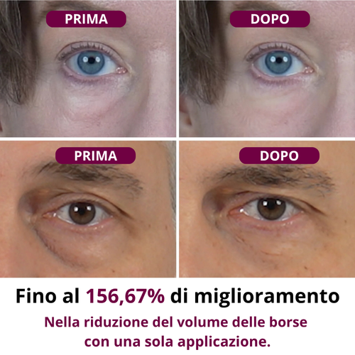 Crema 3 in 1 contro Borse, Occhiaie e Segni del Tempo