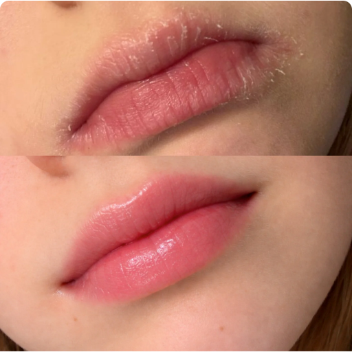 Nimea™- Maschera Labbra Lenitiva